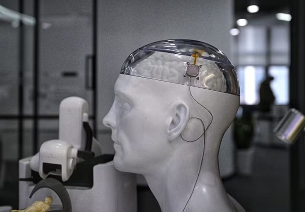Tecnologia : China sai na frente dos EUA e comercializa o primeiro implante cerebral.