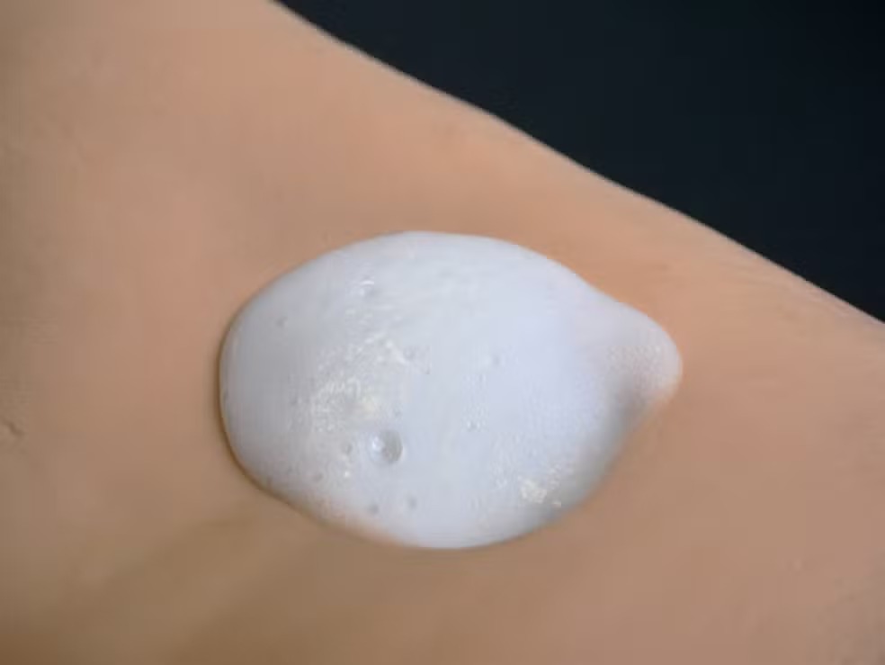 Tecnologia : Nova espuma injetável pode ajudar a prevenir amputações e selar feridas profundas.